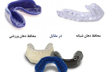 نایت گارد دندان | انواع نایت کارد دندان