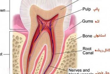 پالپ دندان | درمان پالپ دندان