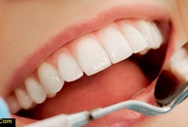 عوارض خطرناک پو سیدگی دندان | درمان عوارض خطرناک پوسیدگی دندان